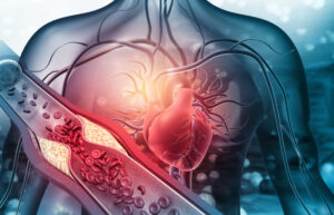 Cardiovasculaire comorbiditeit vast onderdeel reumatologie