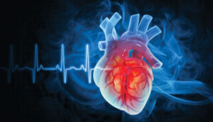 Behandeling van PLN-cardiomyopathie: tussen standaardzorg en gerichte therapie